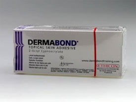 2-Octyl Cyanoacrylate (Dermabond) Wound Adhesives: Product, Design  Features, Indications